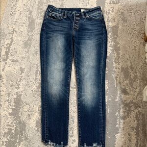 Dark Wash Cropped Jeans